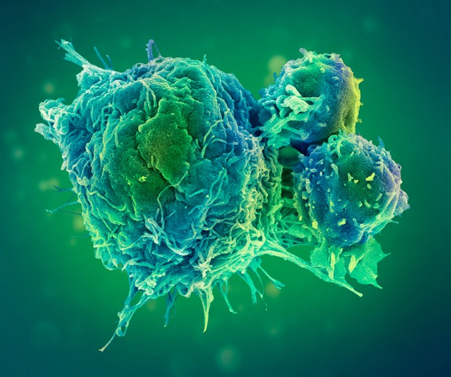 Cancer-cell
